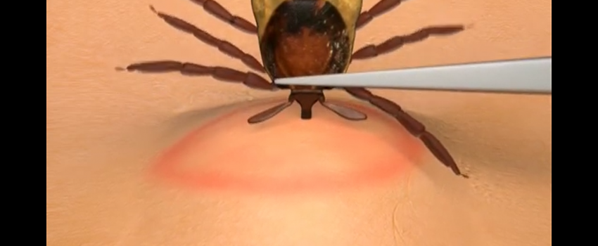 Screenshot 2017-07-08 07.07.24